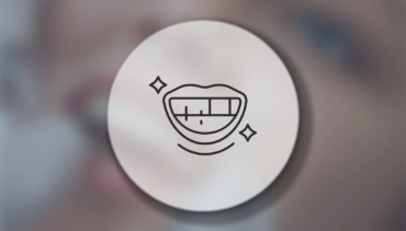 Kayseri Diş Beyazlatma (Bleaching) Tedavisi