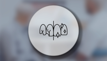 E-Max Kaplama Diş Tedavisi