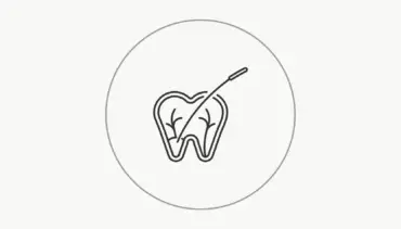 Kayseri Kanal Tedavisi (Endodonti)