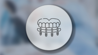 All on Four İmplant Tedavisi Nedir?