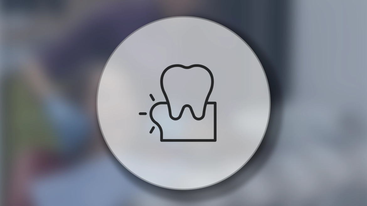 Kayseri Diş Eti Tedavisi (Periodontoloji)