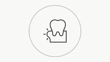 Diş Eti Tedavisi-Periodontoloji