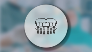 All-on-Six İmplant Tedavisi Nedir?