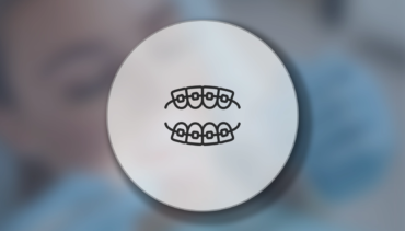 Kayseri Diş Teli ve Ortodonti Tedavileri