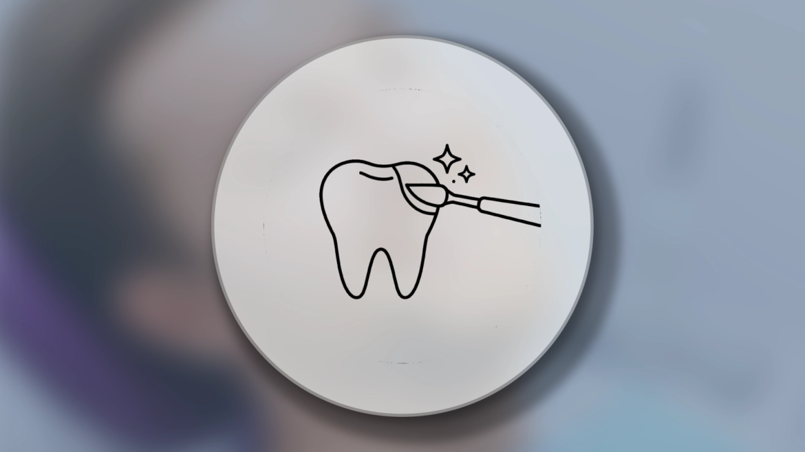 Estetik Diş Dolgusu (Kompozit Bonding)