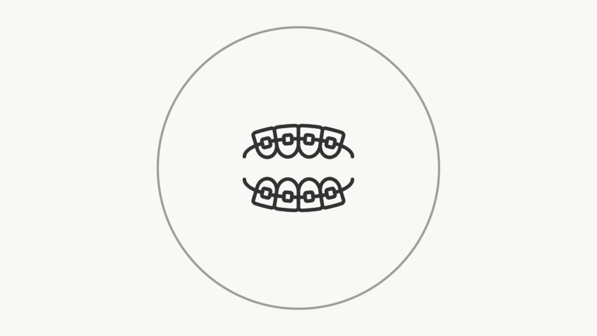 Orthodontic Braces – Clear Aligner Treatment