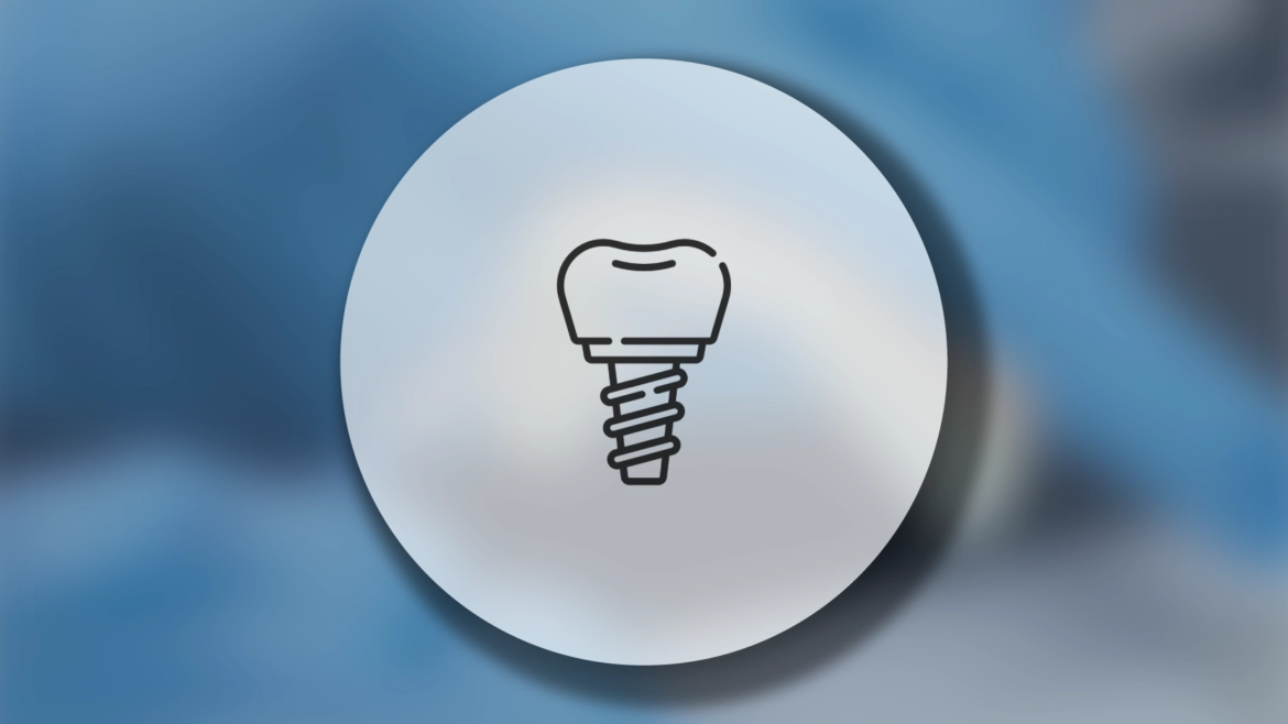  İmplant Tedavisi Kayseri: Adım Adım Uygulama ve 2026 Güncel Fiyat Bilgisi 