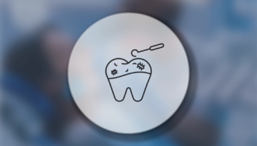 Diş Çürüğü ve Tedavi Yöntemleri