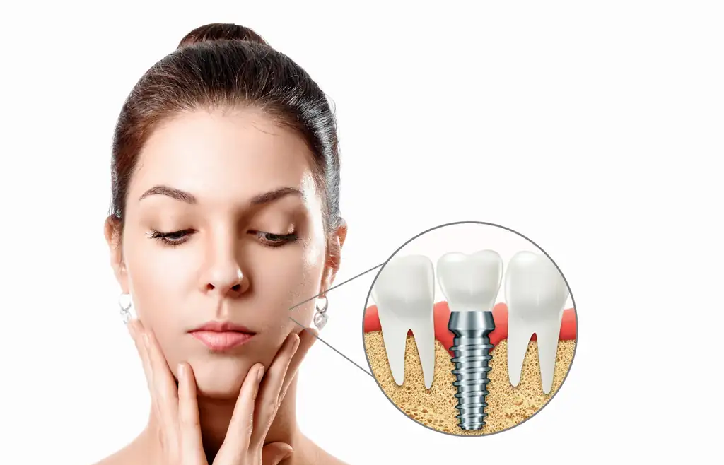 İmplantın Sökülmesi Gereken Durumlar