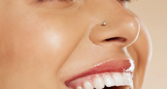 Emax Diş Kaplama Doğal Görünür mü?