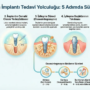 İmplant Tedavisi Sürecinde Bulunan Aşamalar