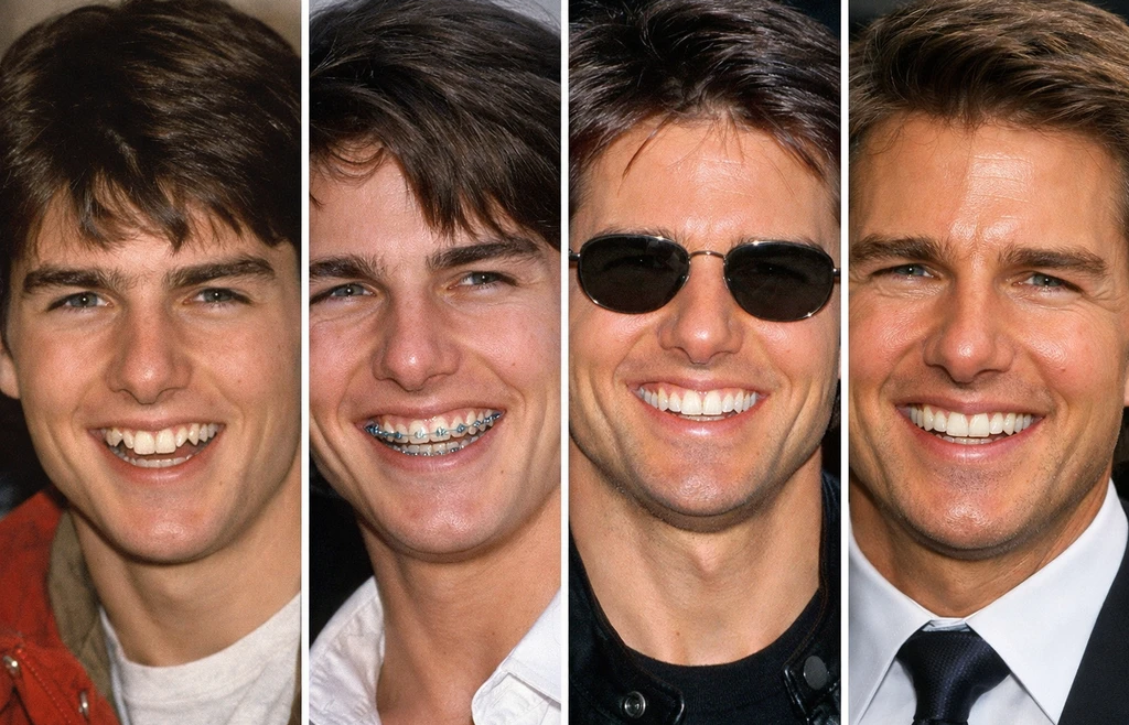 Tom Cruise Dişleri: Gülüş Dönüşümüne ve Modern Estetik Diş Hekimliğine Detaylı Bir Bakış