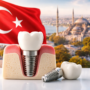 Türkiye’de Diş İmplantı Tedavisi: Süreç, Avantajlar ve Dikkat Edilmesi Gerekenler