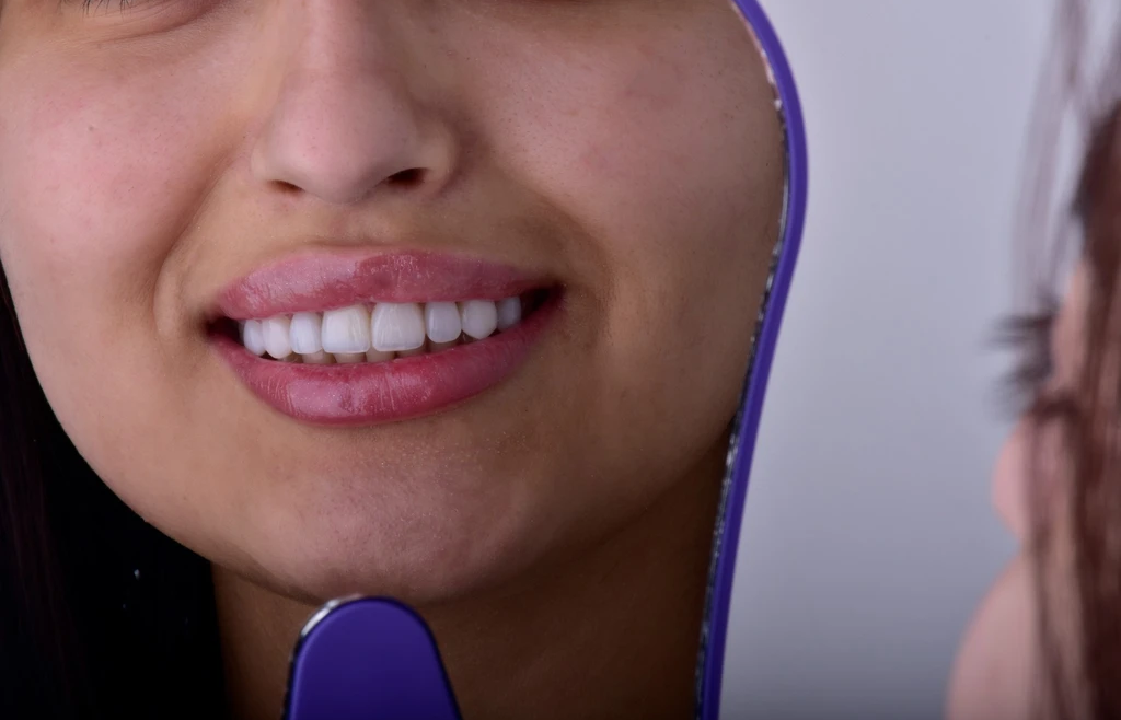 Kayseri Estetik Diş Dolgusu