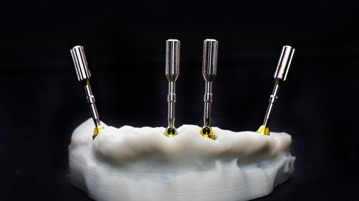 İmplant Dikişleri Alındıktan Sonra Yemek Yenir mi? Beslenme ve İyileşme Süreci