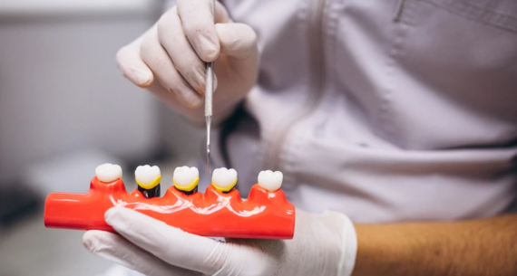 Zirkonyum Porselen Markaları