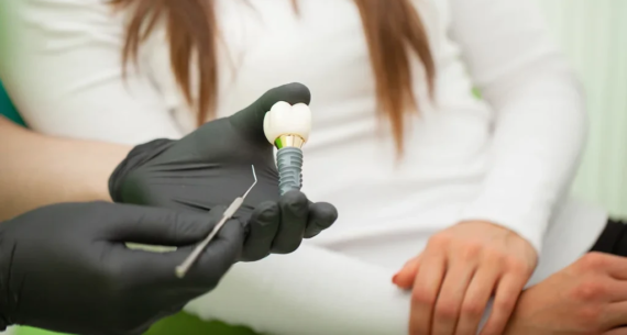 Diş İmplantı Sonrası İyileşme Süreci: Dikkat Gerektiren Noktalar