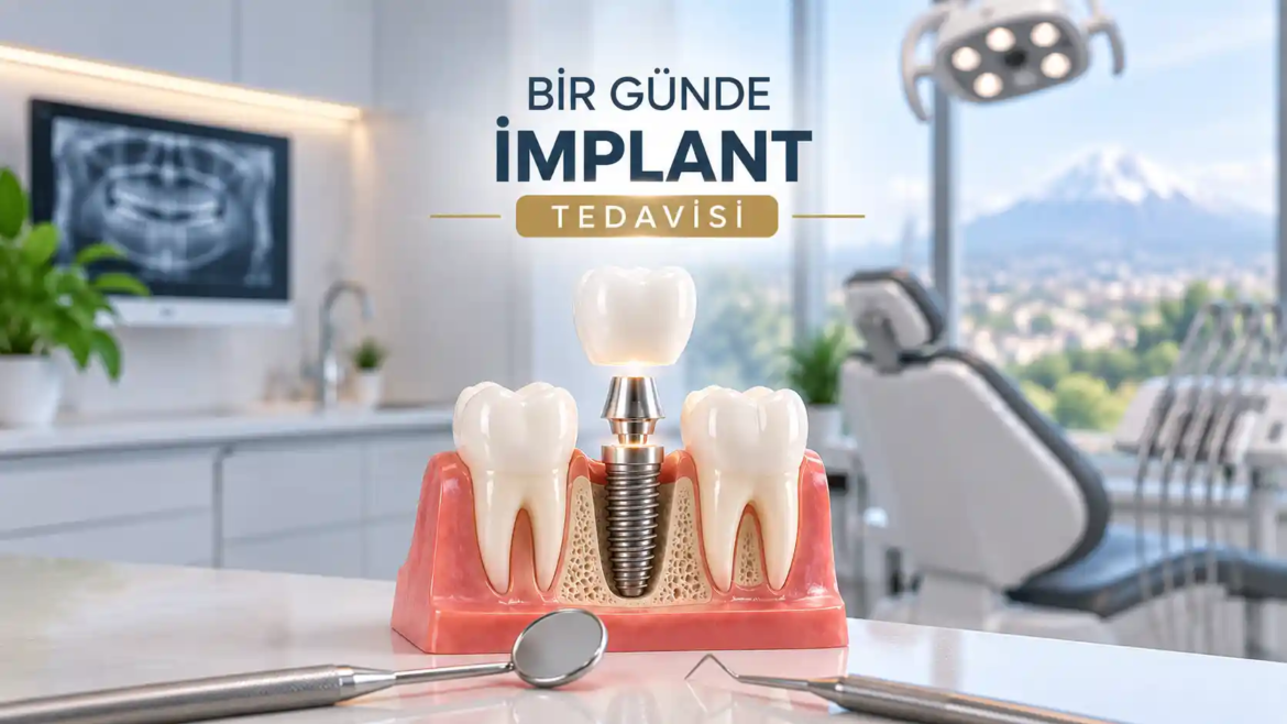 Kayseri – Bir Günde İmplant