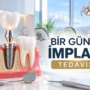 Kayseri – Bir Günde İmplant